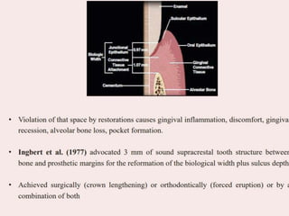 Pps Surgery Periodontal Plastic Surgery (PPS) is a branch of periodontics | PDF