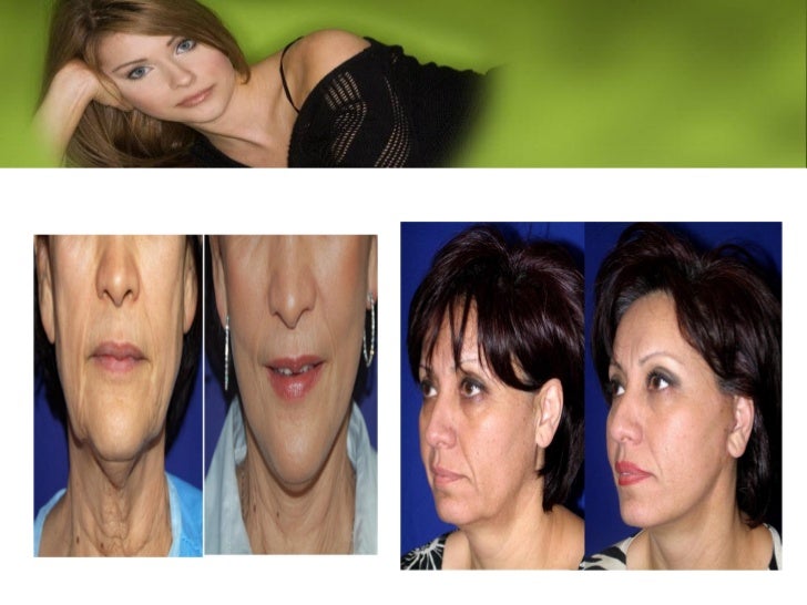 Plastic surgery beverly hills