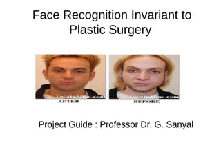 Face Recognition Invariant to
Plastic Surgery
Project Guide : Professor Dr. G. Sanyal
 