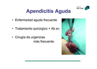 • Enfermedad aguda frecuente
• Tratamiento quirúrgico + Ab ev
• Cirugía de urgencias
más frecuente
Apendicitis Aguda
 