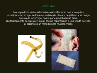 VERRUGAS

      Los seguidores de las alternativas naturales juran que si se quiere
 erradicar una verruga, se tome un pedazo de cáscara de plátano y se ponga
            encima de la verruga, con la parte amarilla hacia fuera.
Cuidadosamente se sujeta en la piel con un esparadrapo o una venda de yeso.
                El plátano es un remedio para muchos males.
 