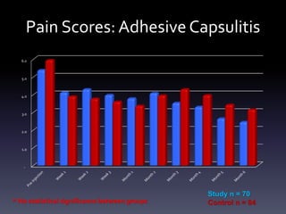 Subacromial Injection
 