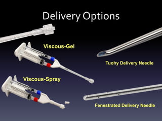 Calcific Tendonitis
  7.0


  6.0


  5.0


  4.0


  3.0


  2.0


  1.0


   -




                                               Study n = 13
* No statistical significance between groups   Control n = 7
 