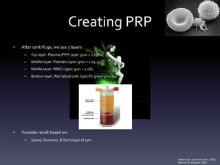 Consensus?
• Marx states PRP = 1,000,000 platelets/uL
• Anitua claims PRP = 300,000 platelets/uL
• Others discuss 3 – 5 fold increase [platelet] > baseline


• What level needed to improve healing?
    – Weibrich suggests that each individual requires a different platelet
      concentration ratio
    – Graziani found 2.5x to be ideal level for osteoblast & fibroblast
      proliferation. Greater levels reduced response       Marx et al, J Oral Maxillofac Surg, 2004.
                                                           Marx et al, Imp Dent, 2001.
                                                           Anitua et al, Thromb Haemost, 2004.
                                                           Marx et al, Bone Engineering, 2000.
                                                           Kevy et al, J Extra Corpor Technol, 2004.
                                                           Gonshor, Int J Periodontics Restorative Dent, 2002.
                                                           Weibrich, J Craniomaxillofac Surg, 2002.
                                                           Graziani et al, Clin Oml Impl Res, 2006
 