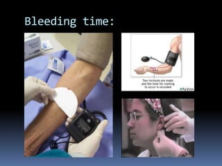 Platelet and coagulation disorder | PPTX