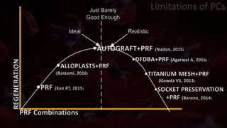 •PRF (Kao RT, 2015)
REGENERATION
PRF Combinations
•SOCKET PRESERVATION
+PRF (Barone, 2014)
•ALLOPLASTS+PRF
(Bastami, 2016) •TITANIUM MESH+PRF
(Gowda VS, 2013)
•AUTOGRAFT+PRF (Nadon, 2015)
•DFDBA+PRF (Agarwal A, 2016)
Limitations of PCs
 