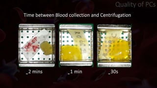 Quality of PCs
Time between Blood collection and Centrifugation
̰2 mins ̰1 min ̰30s
 