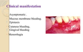 Clinical manifestation
□ Asymptomatic .
□ Mucous membrane bleeding.
 Epistaxis
□ Cutaneus bleeding.
 Gingival bleeding
□ Menorrhagia
 