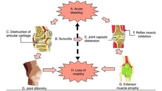 Comprehensive Overview of Platelet Physiology and Coagulation Disorders ...