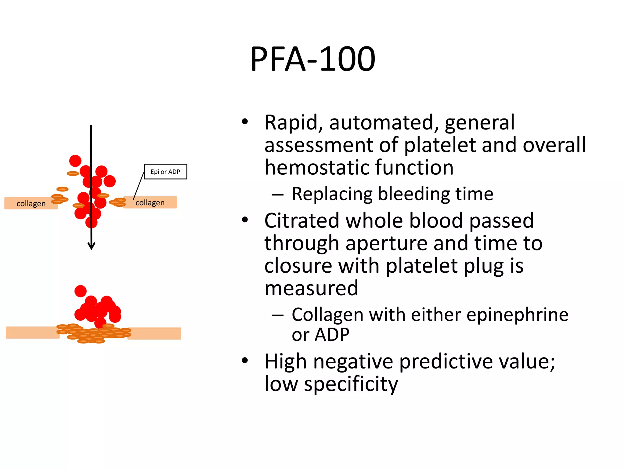 PFA-100
Epi or ADP

collagen

collagen

• Rapid, automated, general
assessment of platelet and overall
hemostatic function
– Replacing bleeding time

• Citrated whole blood passed
through aperture and time to
closure with platelet plug is
measured
– Collagen with either epinephrine
or ADP

• High negative predictive value;
low specificity

 