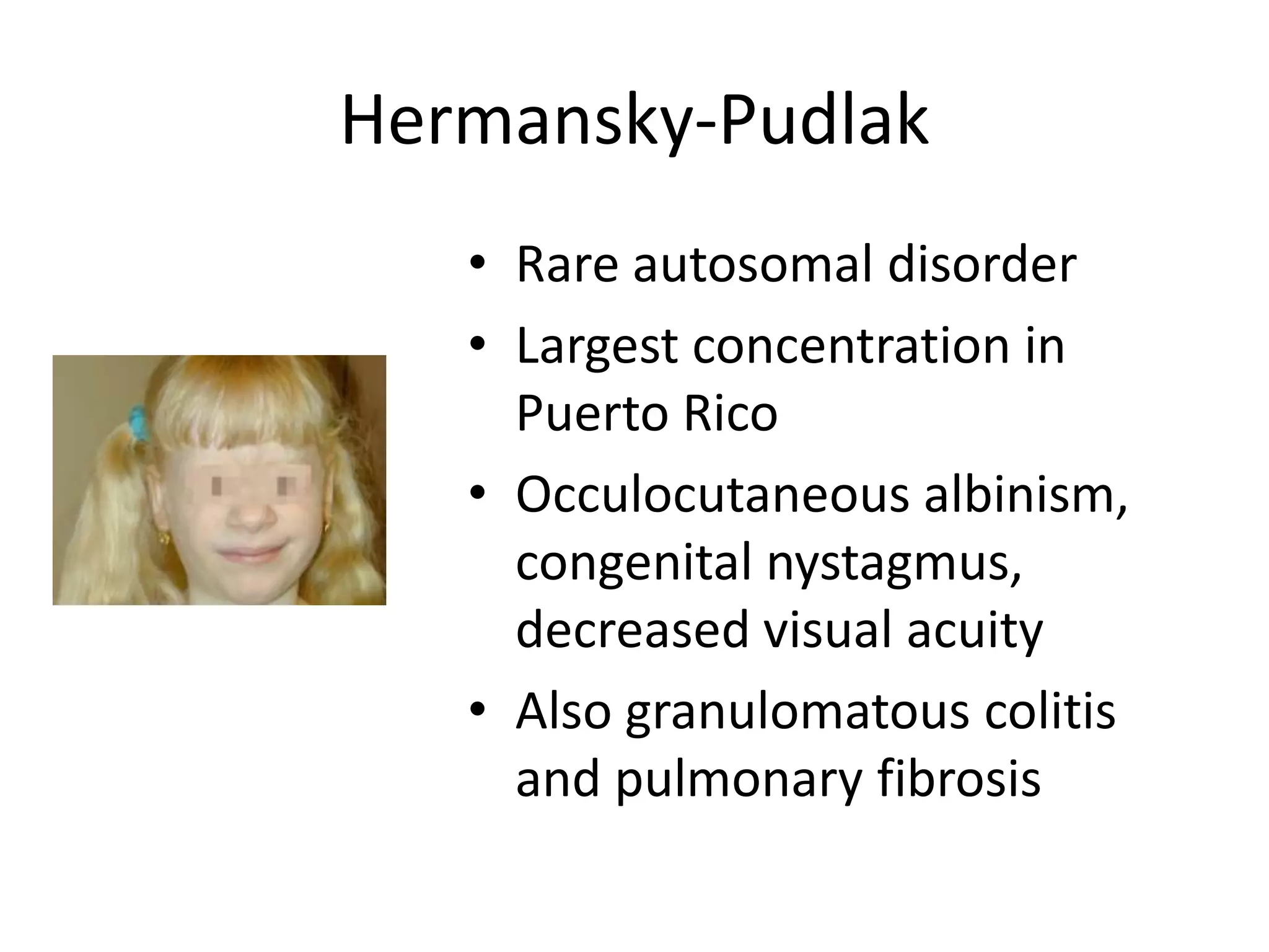 Hermansky-Pudlak
• Rare autosomal disorder
• Largest concentration in
Puerto Rico
• Occulocutaneous albinism,
congenital nystagmus,
decreased visual acuity
• Also granulomatous colitis
and pulmonary fibrosis

 