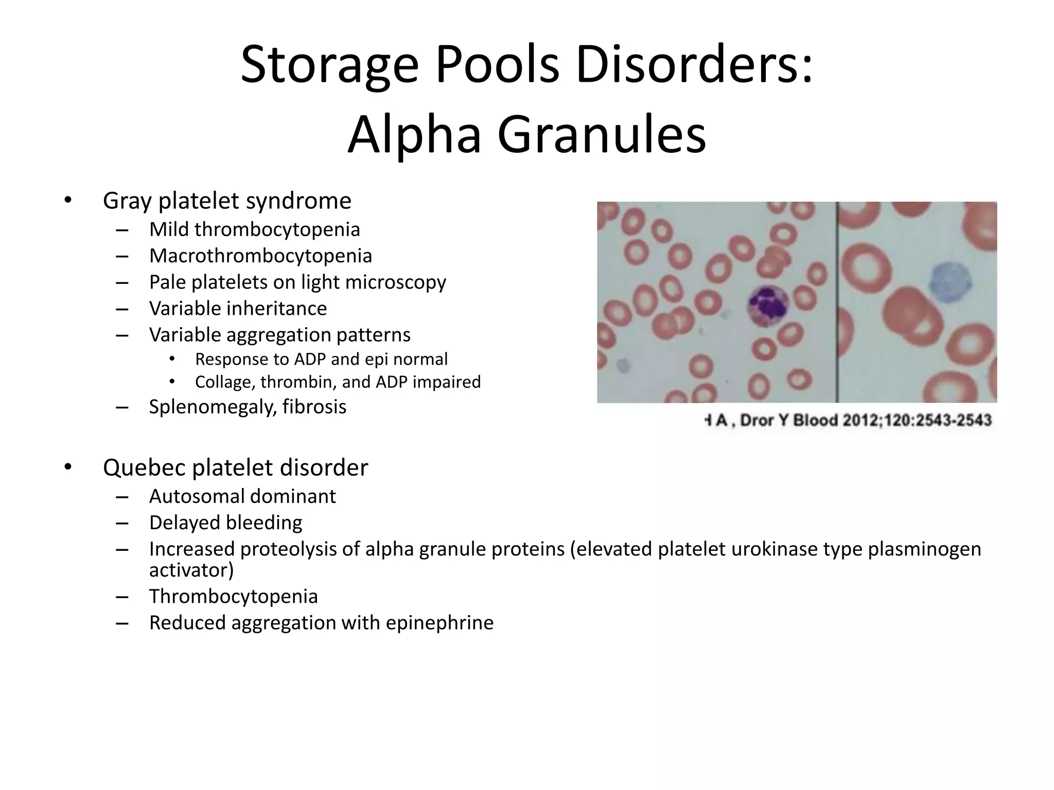 Storage Pools Disorders:
Alpha Granules
•

Gray platelet syndrome
–
–
–
–
–

Mild thrombocytopenia
Macrothrombocytopenia
Pale platelets on light microscopy
Variable inheritance
Variable aggregation patterns
•
•

Response to ADP and epi normal
Collage, thrombin, and ADP impaired

– Splenomegaly, fibrosis

•

Quebec platelet disorder
– Autosomal dominant
– Delayed bleeding
– Increased proteolysis of alpha granule proteins (elevated platelet urokinase type plasminogen
activator)
– Thrombocytopenia
– Reduced aggregation with epinephrine

 
