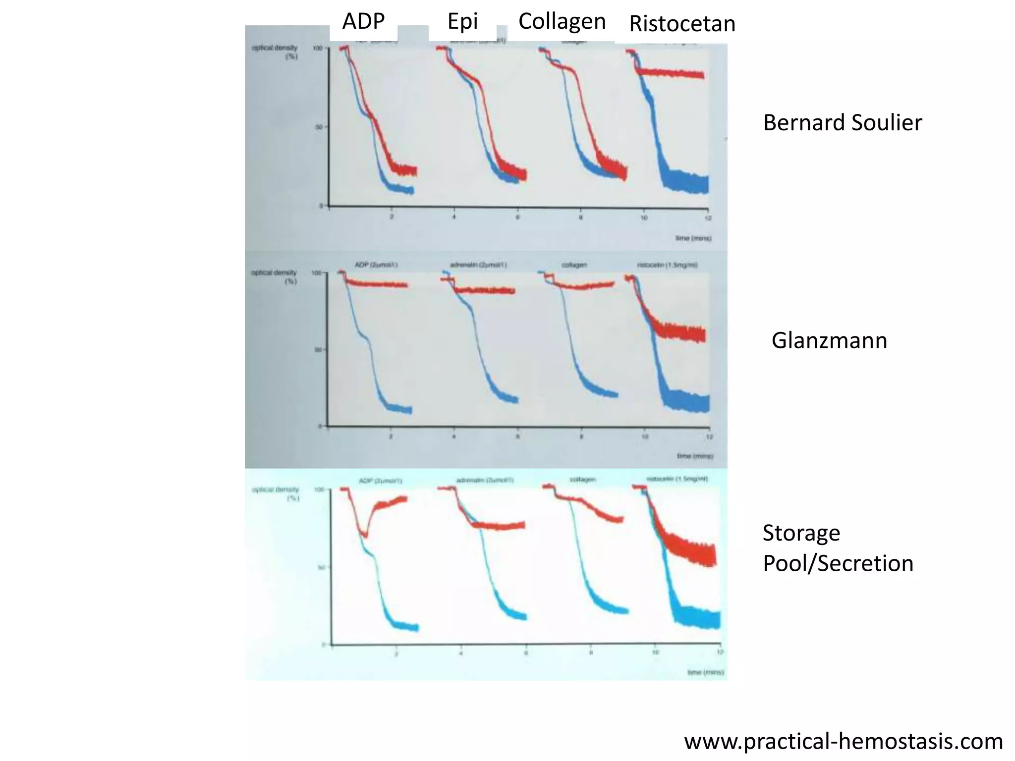 ADP

Epi

Collagen Ristocetan

Bernard Soulier

Glanzmann

Storage
Pool/Secretion

www.practical-hemostasis.com

 