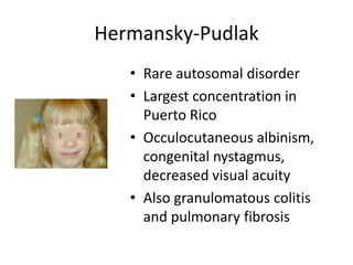 Hermansky-Pudlak
• Rare autosomal disorder
• Largest concentration in
Puerto Rico
• Occulocutaneous albinism,
congenital nystagmus,
decreased visual acuity
• Also granulomatous colitis
and pulmonary fibrosis

 