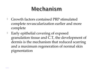  Growth factors contained PRP stimulated
complete revascularization earlier and more
complete
 Early epithelial covering of exposed
granulation tissue and C.T, the development of
dermis is the mechanism that reduced scarring
and a maximum regeneration of normal skin
pigmentation
GDC
 