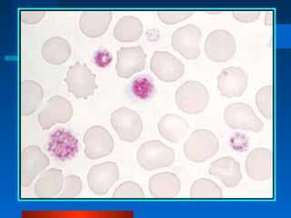 Platelets and platelets disorderz | PPT
