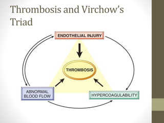 Thrombosis and Virchow’s
Triad
 