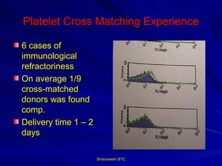 Platelet Cross Matching Experience

6 cases of
immunological
refractoriness
On average 1/9
cross-matched
donors was found
comp.
Delivery time 1 – 2
days

                      Shabrawishi BTC
 