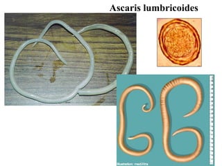 Ascaris lumbricoides
 