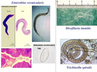 Enterobius vermicularis




                          Dirofilaria immitis




                          Trichinella spiralis
 
