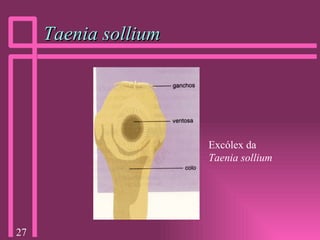 Taenia sollium Excólex da  Taenia sollium 