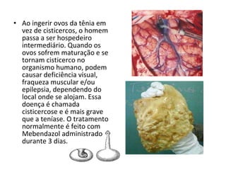 Ao ingerir ovos da tênia em vez de cisticercos, o homem passa a ser hospedeiro intermediário. Quando os ovos sofrem maturação e se tornam cisticerco no organismo humano, podem causar deficiência visual, fraqueza muscular e/ou epilepsia, dependendo do local onde se alojam. Essa doença é chamada cisticercose e é mais grave que a teníase. O tratamento normalmente é feito com Mebendazol administrado durante 3 dias. 