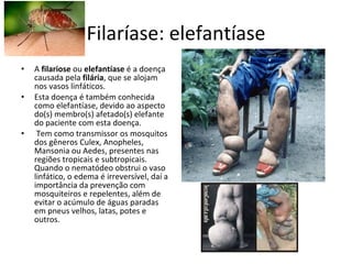 Filaríase: elefantíase A  filariose  ou  elefantíase  é a doença causada pela  filária , que se alojam nos vasos linfáticos. Esta doença é também conhecida como elefantíase, devido ao aspecto do(s) membro(s) afetado(s) elefante do paciente com esta doença. Tem como transmissor os mosquitos dos gêneros Culex, Anopheles, Mansonia ou Aedes, presentes nas regiões tropicais e subtropicais. Quando o nematódeo obstrui o vaso linfático, o edema é irreversível, daí a importância da prevenção com mosquiteiros e repelentes, além de evitar o acúmulo de águas paradas em pneus velhos, latas, potes e outros. 