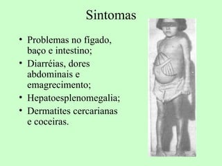 Sintomas
• Problemas no fígado,
  baço e intestino;
• Diarréias, dores
  abdominais e
  emagrecimento;
• Hepatoesplenomegalia;
• Dermatites cercarianas
  e coceiras.
 