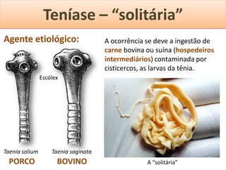 Teníase – “solitária”
Agente etiológico:                    A ocorrência se deve a ingestão de
                                      carne bovina ou suína (hospedeiros
                                      intermediários) contaminada por
                                      cisticercos, as larvas da tênia.
                Escólex




Taenia solium       Taenia saginata
 PORCO                BOVINO                       A “solitária”
 