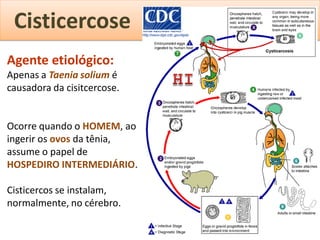 Cisticercose
Agente etiológico:
Apenas a Taenia solium é
causadora da cisitcercose.


Ocorre quando o HOMEM, ao
ingerir os ovos da tênia,
assume o papel de
HOSPEDIRO INTERMEDIÁRIO.

Cisticercos se instalam,
normalmente, no cérebro.
 