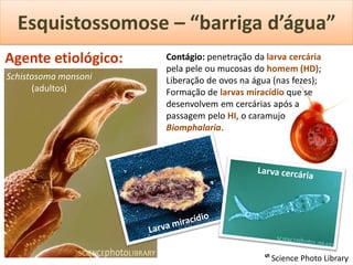 Esquistossomose – “barriga d’água”
Agente etiológico:    Contágio: penetração da larva cercária
                      pela pele ou mucosas do homem (HD);
Schistosoma mansoni   Liberação de ovos na água (nas fezes);
      (adultos)       Formação de larvas miracídio que se
                      desenvolvem em cercárias após a
                      passagem pelo HI, o caramujo
                      Biomphalaria.




                                              ᔥ Science Photo Library
 