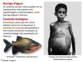 Barriga d’água:
  Os sintomas da fase crônica podem ser as
  hepatopatias/ enteropatias com
  hepatomegalia, esplenomegalia, ascite
  (barriga d’água) e diarreia.
  Controle biológico:
  O tambaqui, peixe que tem como
  hábitat a bacia do rio Amazonas, é
  predador do caramujo Biomphalaria e
  tem trazido excelentes resultados no
  controle biológico das populações do
  molusco.




     Tambaqui - Colossoma macropomum         Criança com pronunciada ascite e
                                                  hepatoesplenomegalia.
ᔥ Google Imagens
 