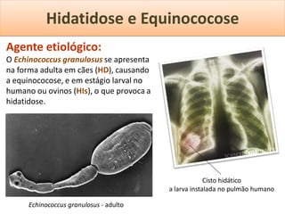 Hidatidose e Equinococose
Agente etiológico:
O Echinococcus granulosus se apresenta
na forma adulta em cães (HD), causando
a equinococose, e em estágio larval no
humano ou ovinos (HIs), o que provoca a
hidatidose.




                                                       Cisto hidático
                                          a larva instalada no pulmão humano

      Echinococcus granulosus - adulto
 