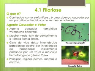 4.1 Filariose
O que é?
 Conhecida como elefantíase , é uma doença causada por
um parasita conhecido como vermes nematóides.
Agente Causador e Vetor
 Agente causador nematóide
Wuchereria bancrofti.
 Macho mede 4cm de comprimento
e fêmea 7cm a 10cm.
 Ciclo de vida desse invertebrado
patogênico ocorre por intervenção
de hospedeiro: inicialmente
passando por um vetor o mosquito
hematófago do gênero Culex
 Principais regiões pernas, mamas e
escroto.
Wuchereria bancrofti
Mosquito Culex
 