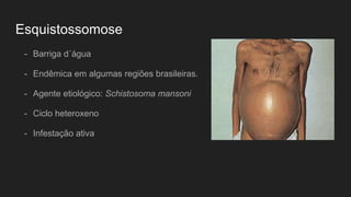 Esquistossomose
- Barriga d´água
- Endêmica em algumas regiões brasileiras.
- Agente etiológico: Schistosoma mansoni
- Ciclo heteroxeno
- Infestação ativa
 