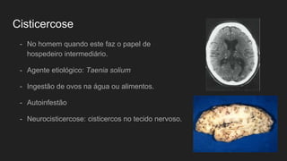 Cisticercose
- No homem quando este faz o papel de
hospedeiro intermediário.
- Agente etiológico: Taenia solium
- Ingestão de ovos na água ou alimentos.
- Autoinfestão
- Neurocisticercose: cisticercos no tecido nervoso.
 