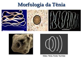 Morfologia da TêniaMorfologia da Tênia
Vídeo: Tênia. Fonte: YouTube
 