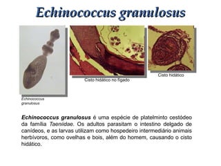 Cisto hidático
Cisto hidático no fígado
Echinococcus
granulosus
Echinococcus granulosusEchinococcus granulosus
Echinococcus granulosus é uma espécie de platelminto cestódeo
da família Taeniidae. Os adultos parasitam o intestino delgado de
canídeos, e as larvas utilizam como hospedeiro intermediário animais
herbívoros, como ovelhas e bois, além do homem, causando o cisto
hidático.
 
