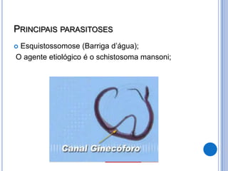 PRINCIPAIS PARASITOSES
Esquistossomose (Barriga d’água);
O agente etiológico é o schistosoma mansoni;
 