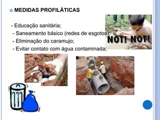    MEDIDAS PROFILÁTICAS

- Educação sanitária;
 - Saneamento básico (redes de esgotos);
 - Eliminação do caramujo;
 - Evitar contato com água contaminada;
 