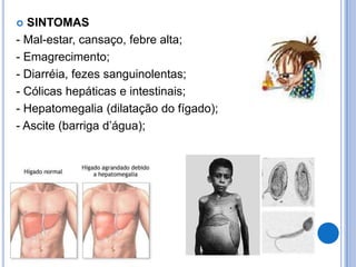   SINTOMAS
- Mal-estar, cansaço, febre alta;
- Emagrecimento;
- Diarréia, fezes sanguinolentas;
- Cólicas hepáticas e intestinais;
- Hepatomegalia (dilatação do fígado);
- Ascite (barriga d’água);
 
