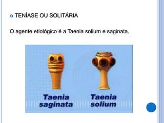    TENÍASE OU SOLITÁRIA

O agente etiológico é a Taenia solium e saginata.
 
