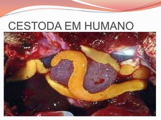 TREMATODA (TREMATÓDEOS)Vermes parasitas com epiderme não-ciliadas e uma ou mais ventosa.Fasciola hepática