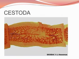 Fasciola hepática