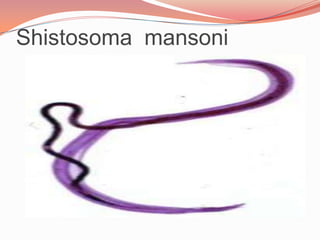 DOENÇAS CAUSADAS POR PLATELMINTOS:ESQUISTOSSOMOSE(barriga d`água: Infecção causada por verme parasita da classe Trematoda. Ocorre em diversas partes do mundo de forma não controlada (endêmica). Nestes locais o número de pessoas com esta parasitose se mantém mais ou menos constante. 