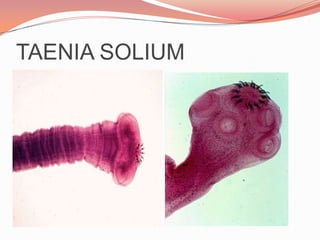 TENÍASE:A teníase é uma doença causada pela forma adulta das tênias, Taenia solium, do porco e Taenia saginata, do boi). Muitas vezes, o paciente nem sabe que convive com o parasita em seu intestino delgado. As tênias também são chamadas de "solitárias", porque, na maioria dos caso, o portador traz apenas um verme adulto.