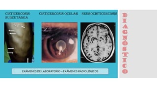 D
I
A
G
n
ó
S
T
I
C
O
Cisticercosis
Subcutánea
Cisticercosis Ocular Neurocisticercosis
EXÁMENES DE LABORATORIO – EXÁMENES RADIOLÓGICOS
 
