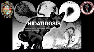 HIDATIDOSIS
o Choquecahua Castro Brisa Jimena
o Centeno Roiro Erick
 