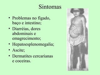 Sintomas
• Problemas no fígado,
  baço e intestino;
• Diarréias, dores
  abdominais e
  emagrecimento;
• Hepatoesplenomegalia;
• Ascite;
• Dermatites cercarianas
  e coceiras.
 