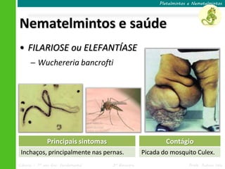 Ciências – 7º ano Ens. Fundamental 3º Bimestre Profa. Rebeca Vale
Nematelmintos e saúde
Platelmintos e Nematelmintos
• FILARIOSE ou ELEFANTÍASE
─ Wuchereria bancrofti
Principais sintomas
Inchaços, principalmente nas pernas.
Contágio
Picada do mosquito Culex.
 